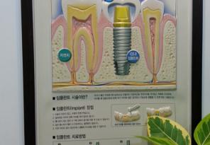 [진료정보/안내제작] 병원/치과/소아과 안내판 치과-임플란트정보